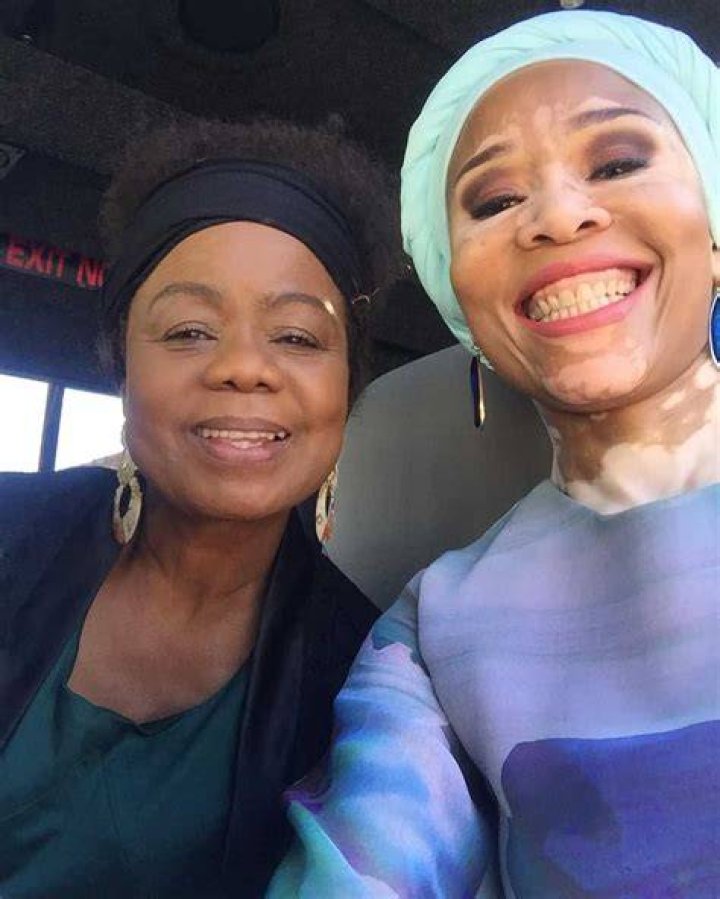 Leleti Khumalo bio age, skin condition, twins, husband, and more
