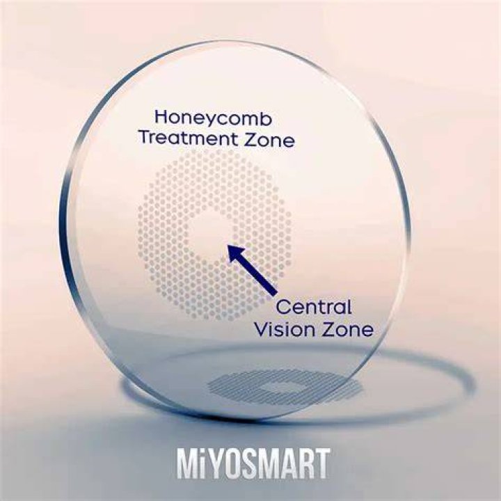 Myopia Control MiYoSmart VisionCare OptometryVisionCare Optometry
