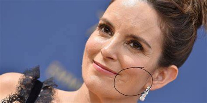 Origins of Celebrity Scars