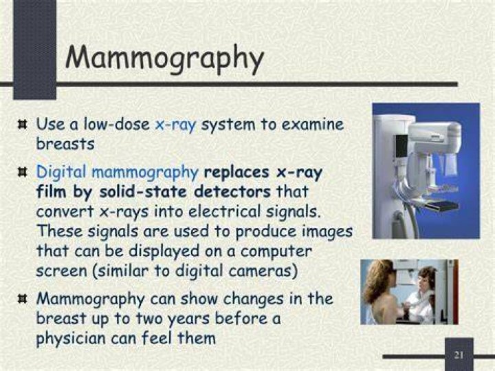 PPT Mammography 2 PowerPoint Presentation, free download ID4110986