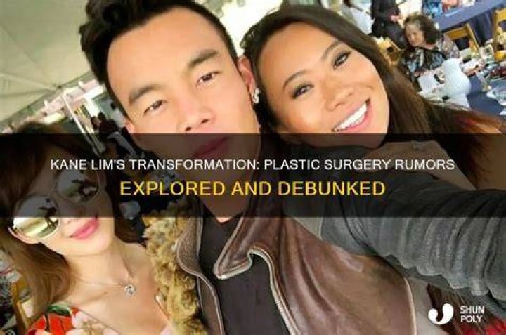 The Transformation Of Kane Lim From Bling Empire